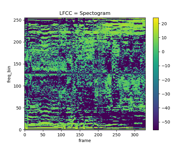 MFCC Spectogram